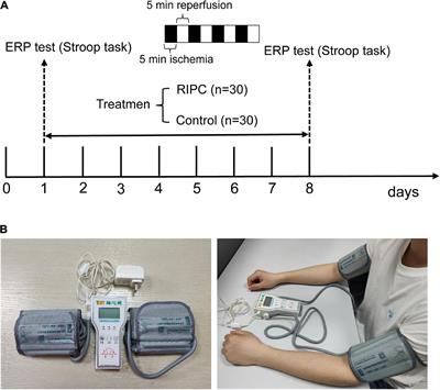 Remote ischemic preconditioning improves cognitive control in healthy adults: Evidence from an event-related potential study